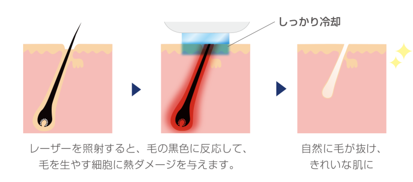 フォーマ・アルファ