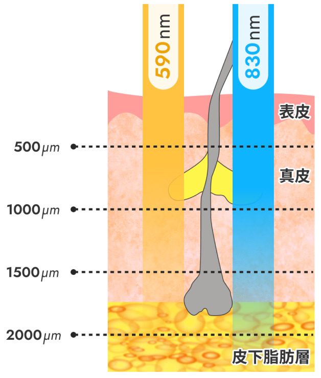 590nmから830nmへ 世界初の連続照射システム