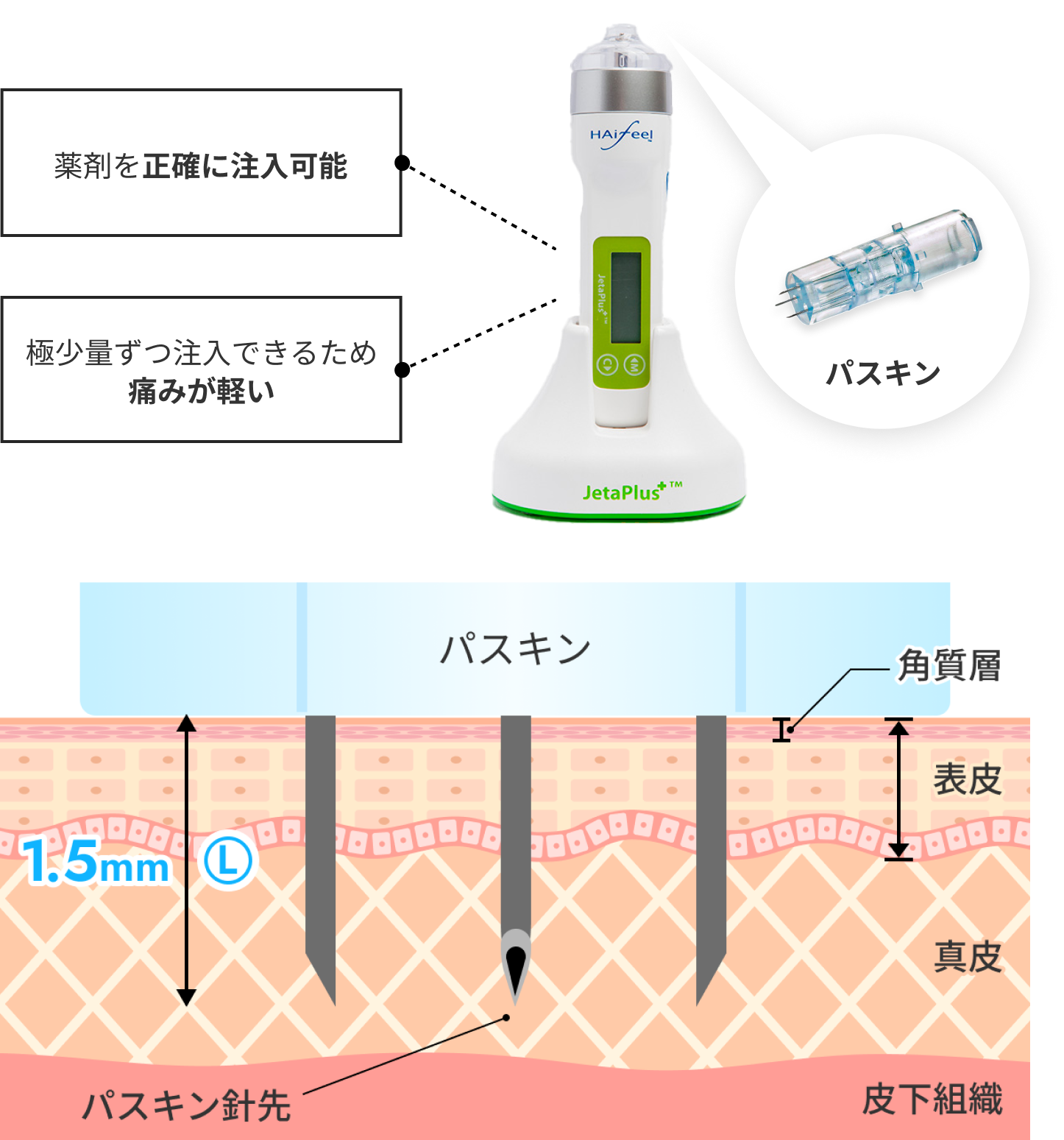 ハイジェッタの優れる点