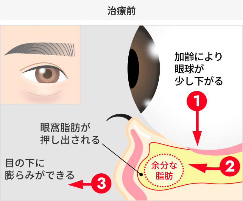 治療前
