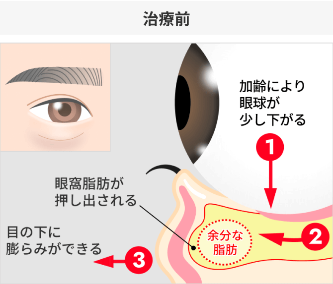 治療前