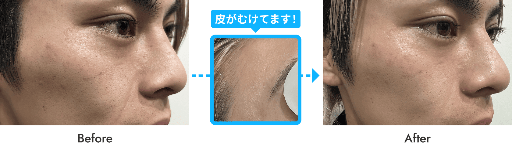 治療の経過